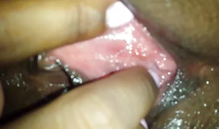 नर्स Abon kicks नर्स हिंदी सेक्सी फुल वीडियो